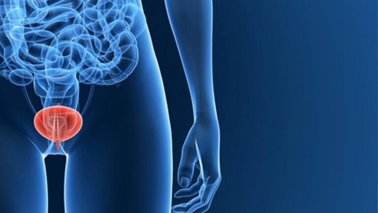 Mengenali Perubahan Tubuh yang Berkaitan dengan Cystitis